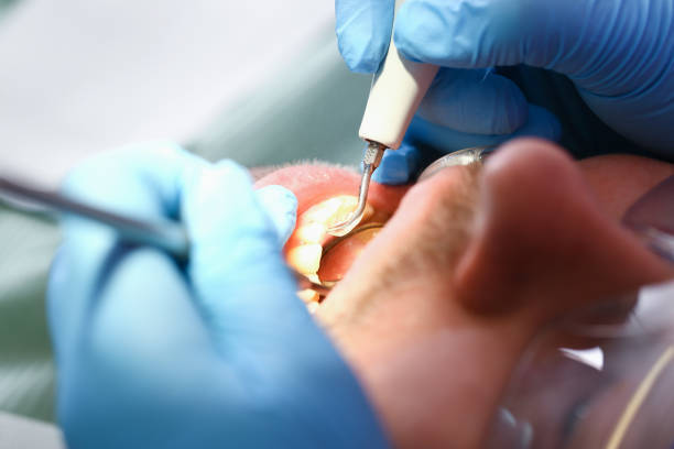 Best Emergency Tooth Extraction in Justice, IL